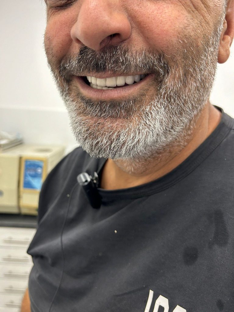 יישור שיניים שקוף