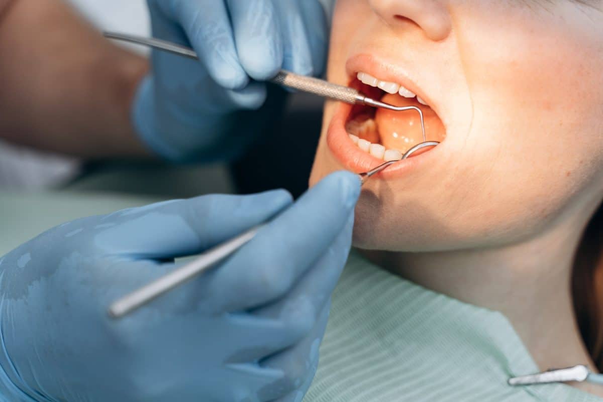 הלבנת שיניים בבני ברק