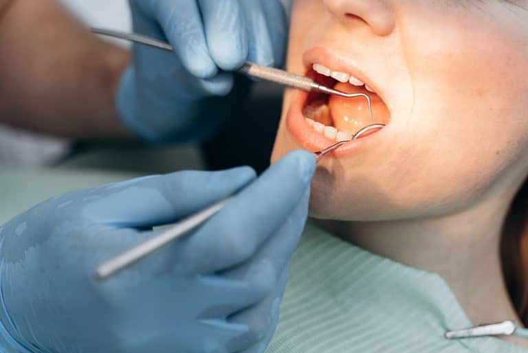 הלבנת שיניים בבני ברק