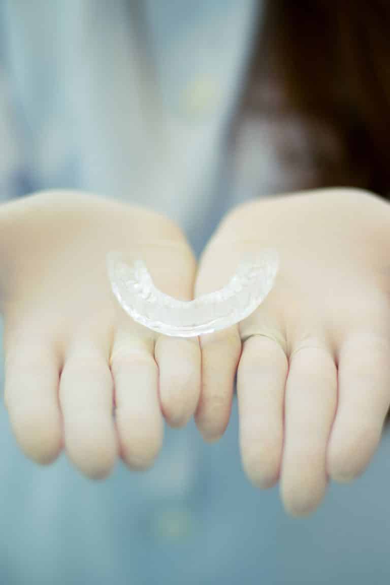פלטת יישור שיניים שקופה